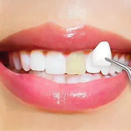 Restorative Dentistry
